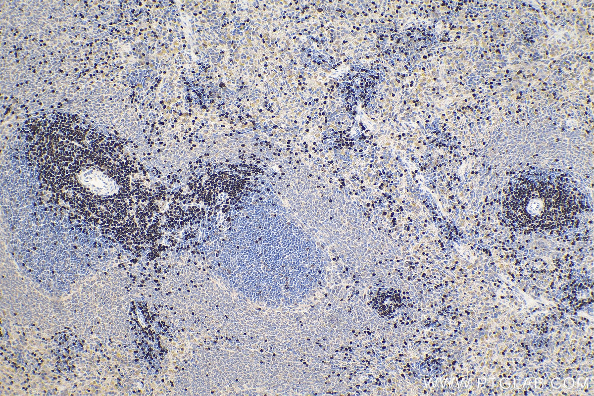 Immunohistochemical analysis of paraffin-embedded rat spleen tissue slide using KHC1599 (TCF7 IHC Kit).