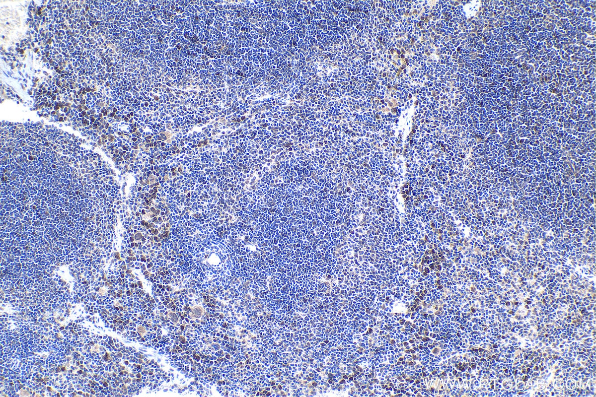 Immunohistochemical analysis of paraffin-embedded mouse spleen tissue slide using KHC1347 (TCL1A IHC Kit).
