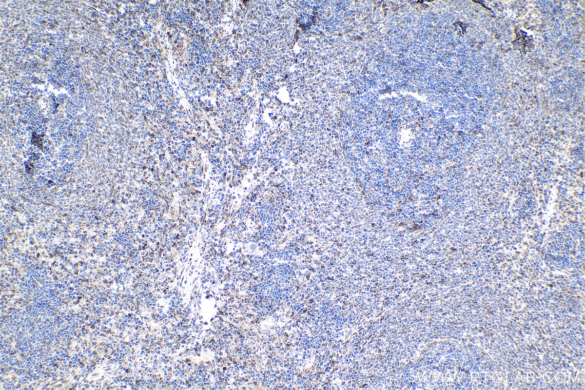 Immunohistochemical analysis of paraffin-embedded rat spleen tissue slide using KHC1347 (TCL1A IHC Kit).