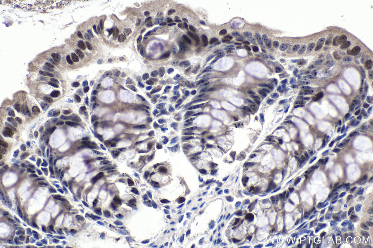 Immunohistochemical analysis of paraffin-embedded mouse colon tissue slide using KHC1017 (TCOF1 IHC Kit).