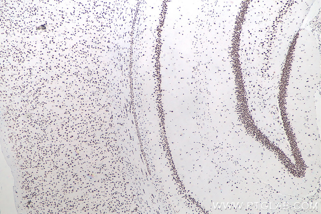 Immunohistochemical analysis of paraffin-embedded rat brain tissue slide using KHC0001 (TDP-43 IHC Kit).