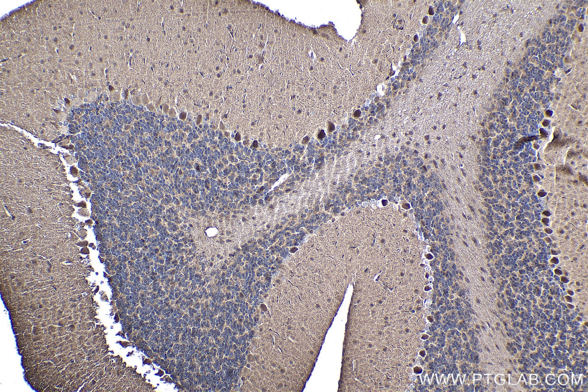 Immunohistochemical analysis of paraffin-embedded mouse cerebellum tissue slide using KHC1495 (TDP2 IHC Kit).