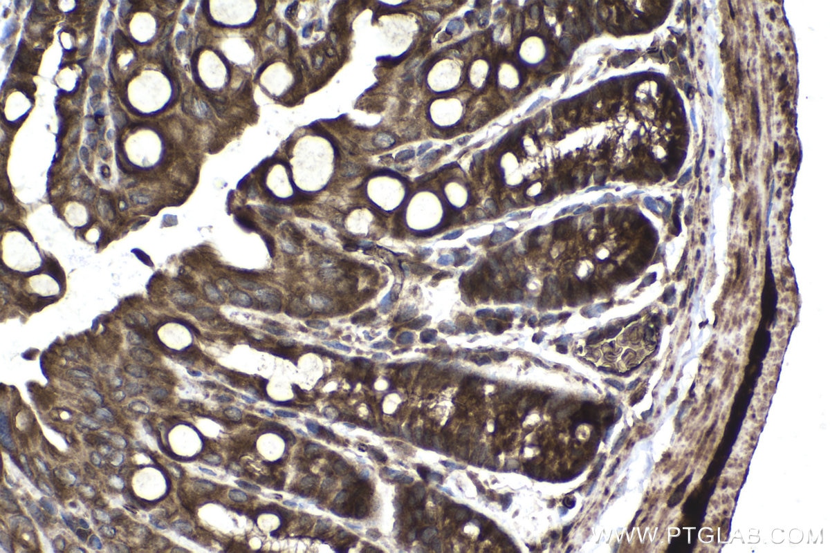 Immunohistochemical analysis of paraffin-embedded mouse colon tissue slide using KHC1495 (TDP2 IHC Kit).