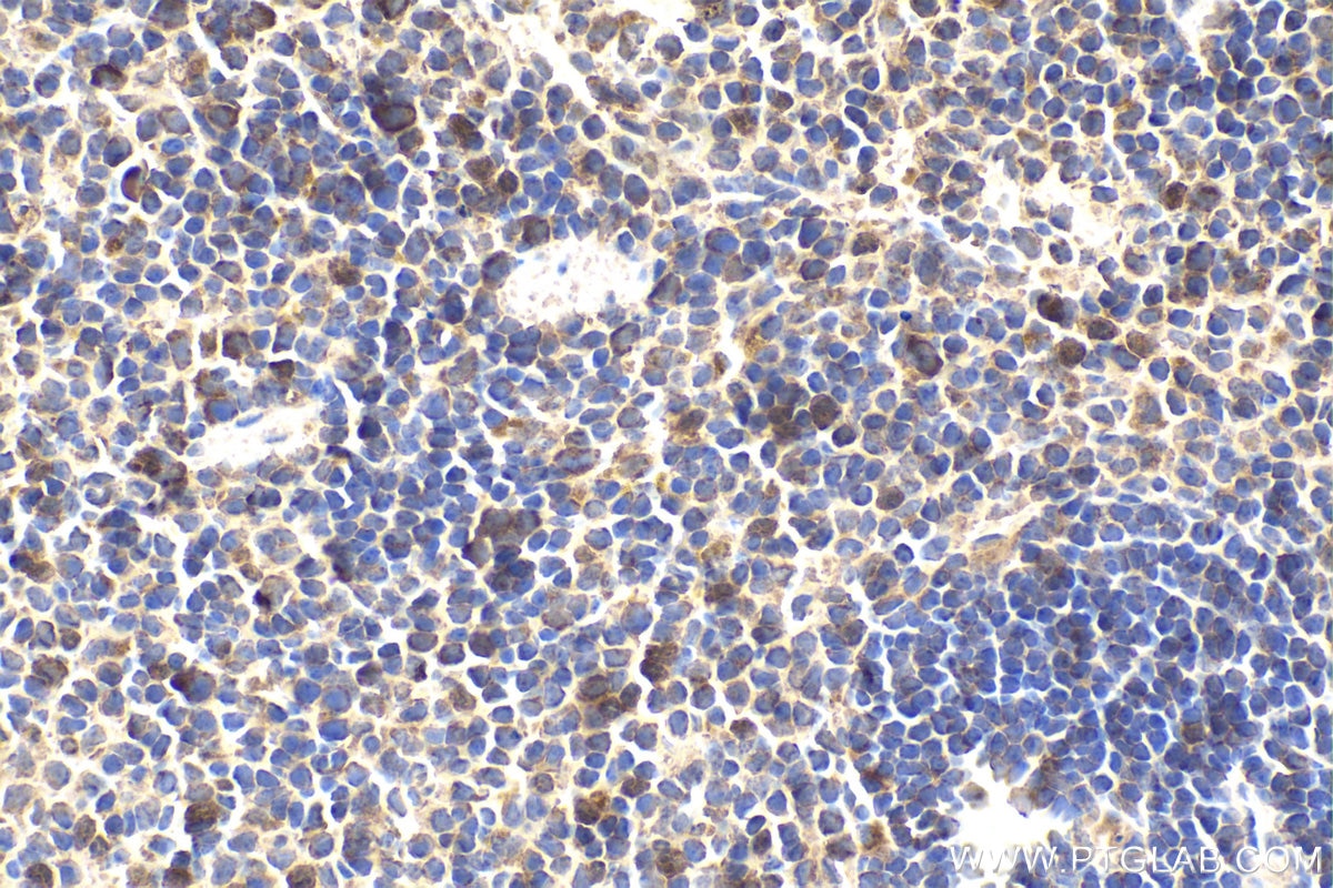 Immunohistochemical analysis of paraffin-embedded mouse spleen tissue slide using KHC1869 (TESC IHC Kit).