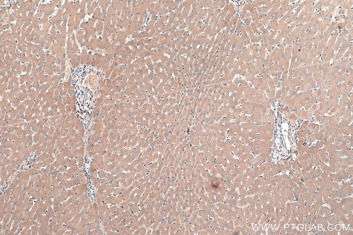 Immunohistochemical analysis of paraffin-embedded human liver tissue slide using KHC0377 (TF IHC Kit).