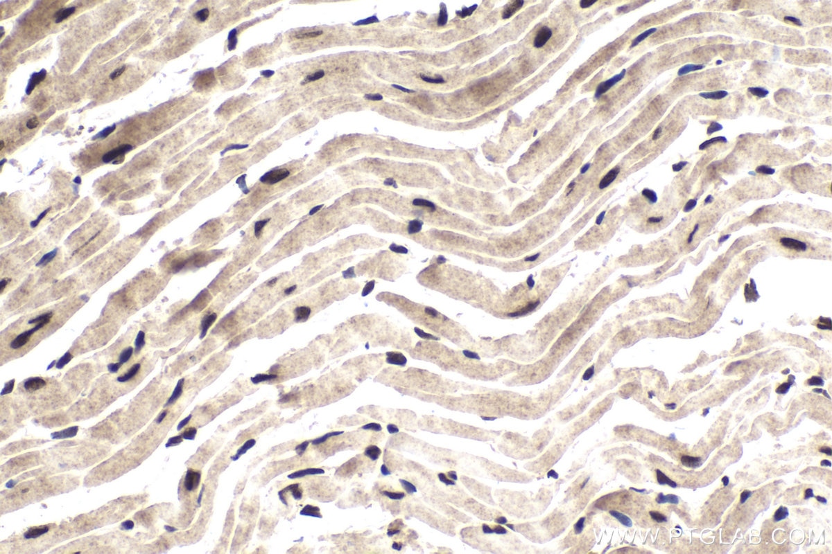 Immunohistochemical analysis of paraffin-embedded mouse heart tissue slide using KHC1726 (TFDP1 IHC Kit).