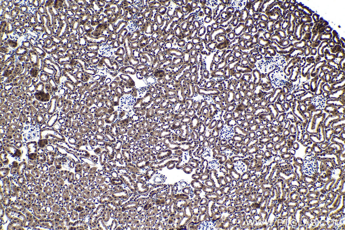 Immunohistochemical analysis of paraffin-embedded mouse kidney tissue slide using KHC1726 (TFDP1 IHC Kit).