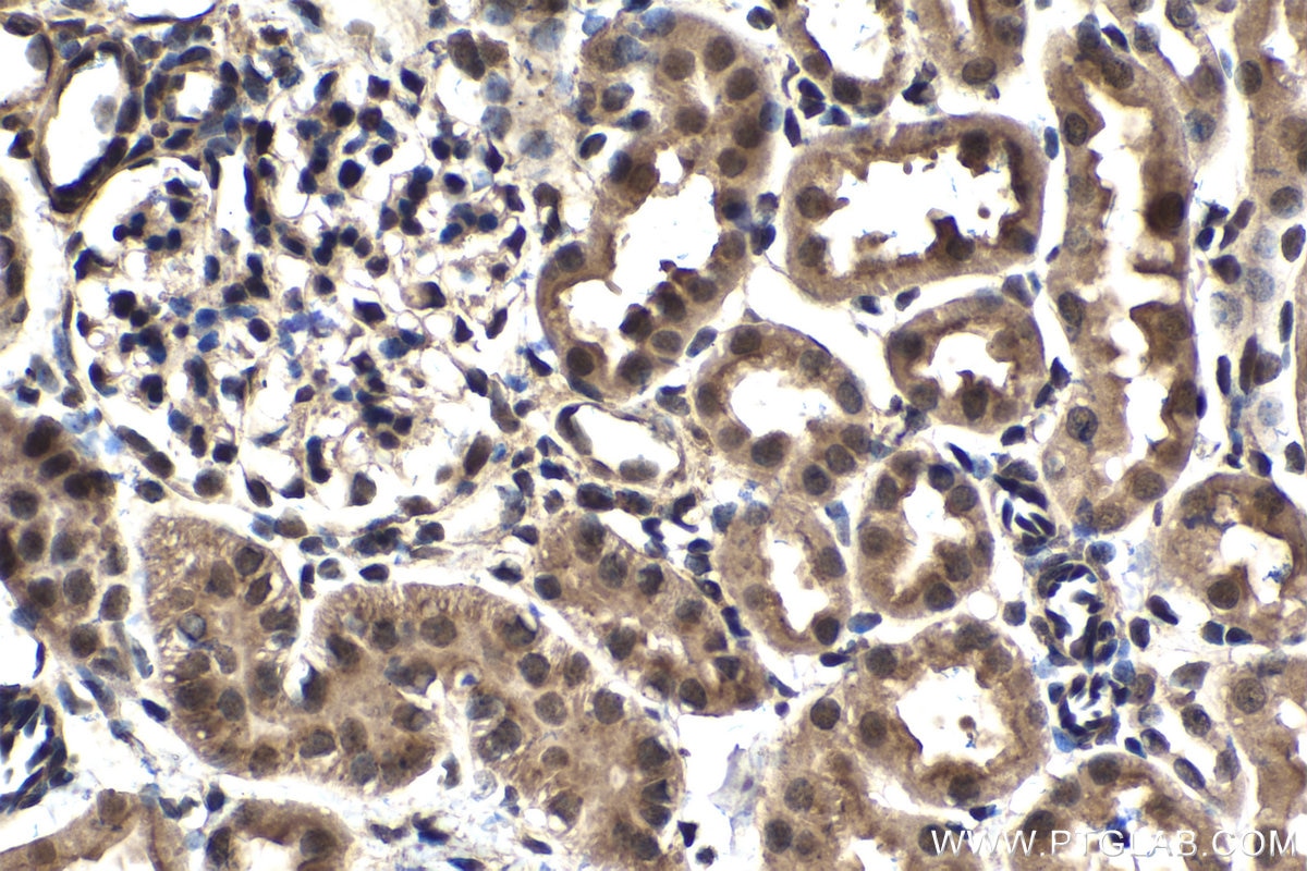 Immunohistochemical analysis of paraffin-embedded mouse kidney tissue slide using KHC1547 (TFE3 IHC Kit).