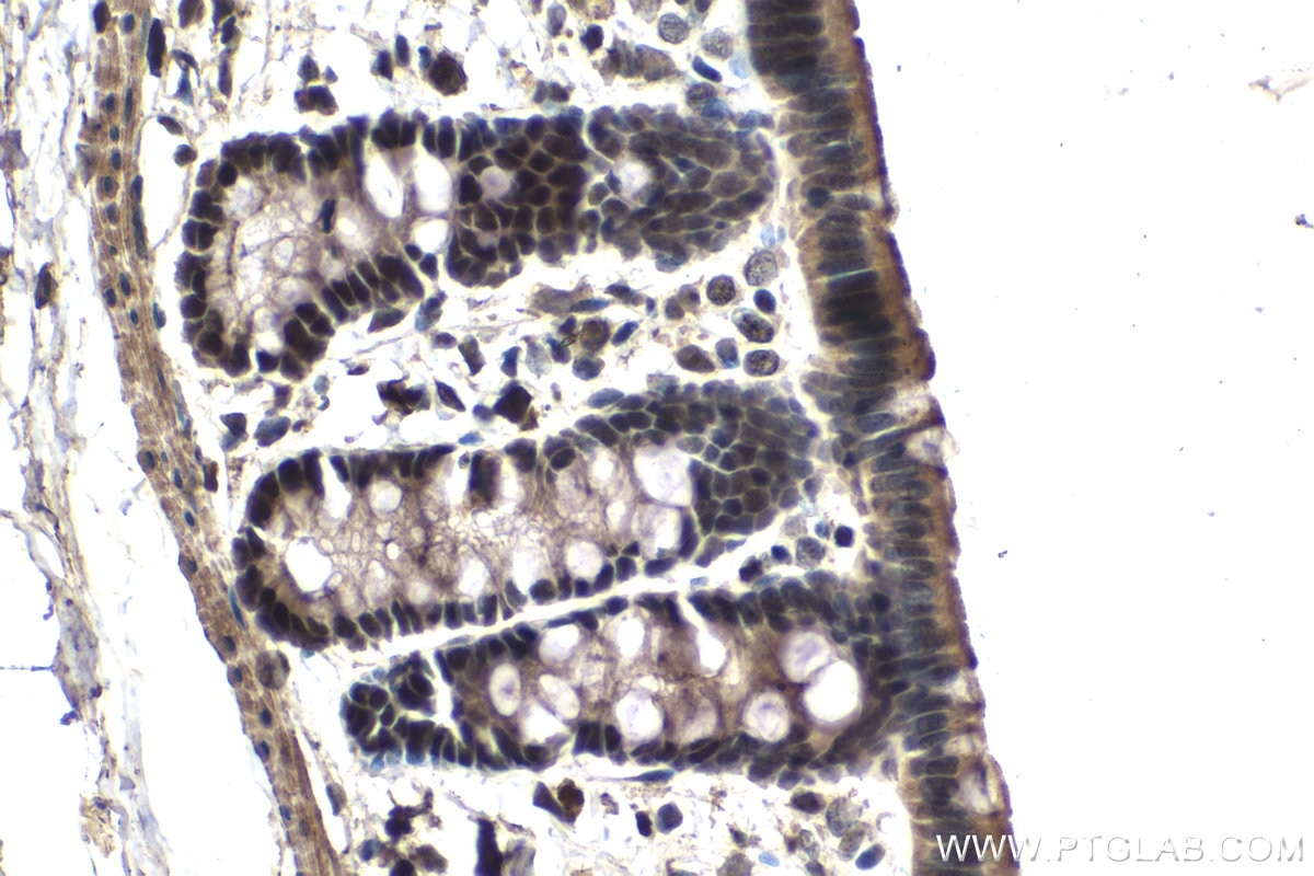 Immunohistochemical analysis of paraffin-embedded rat colon tissue slide using KHC1547 (TFE3 IHC Kit).