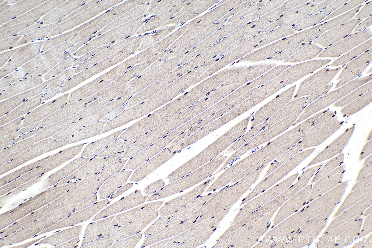 Immunohistochemical analysis of paraffin-embedded mouse skeletal muscle tissue slide using KHC1545 (TFEB IHC Kit).