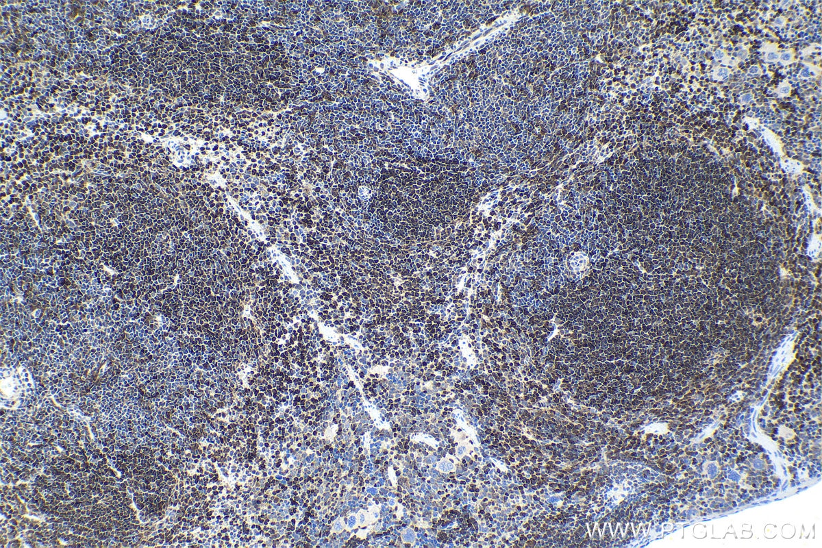 Immunohistochemical analysis of paraffin-embedded mouse spleen tissue slide using KHC1545 (TFEB IHC Kit).