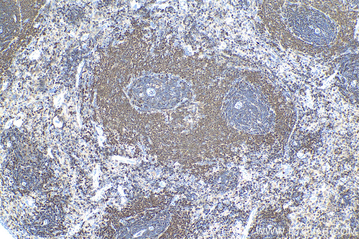 Immunohistochemical analysis of paraffin-embedded rat spleen tissue slide using KHC1545 (TFEB IHC Kit).