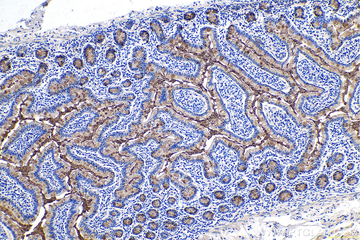 Immunohistochemical analysis of paraffin-embedded human small intestine tissue slide using KHC0648 (TFF3 IHC Kit).