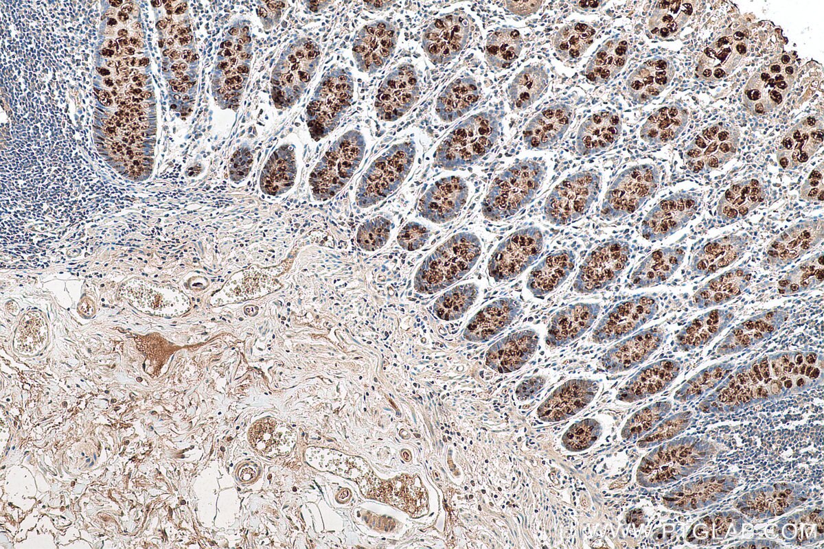 Immunohistochemical analysis of paraffin-embedded human colon tissue slide using KHC0648 (TFF3 IHC Kit).