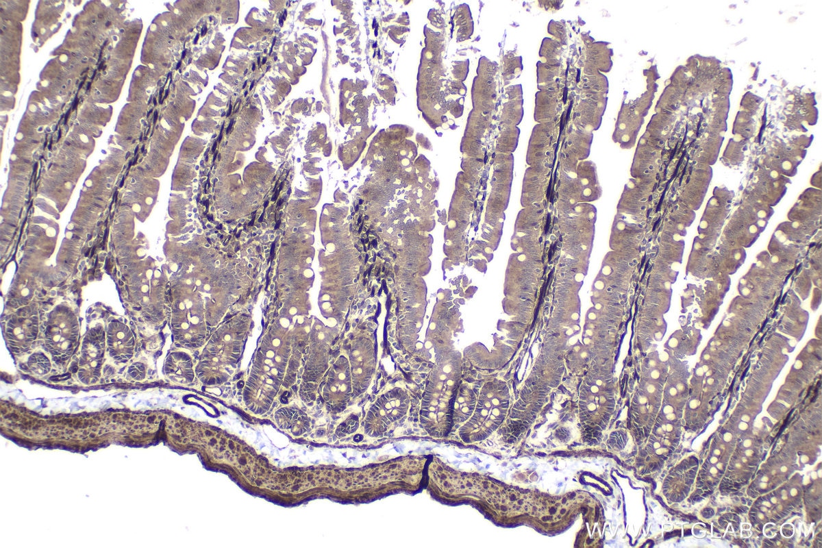 Immunohistochemical analysis of paraffin-embedded rat small intestine tissue slide using KHC1453 (TGFB1I1/HIC5 IHC Kit).
