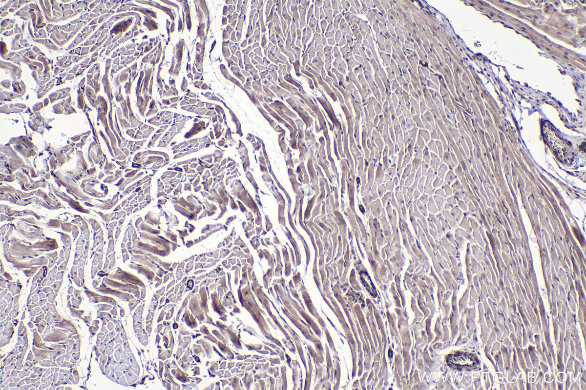 Immunohistochemical analysis of paraffin-embedded rat heart tissue slide using KHC1453 (TGFB1I1/HIC5 IHC Kit).