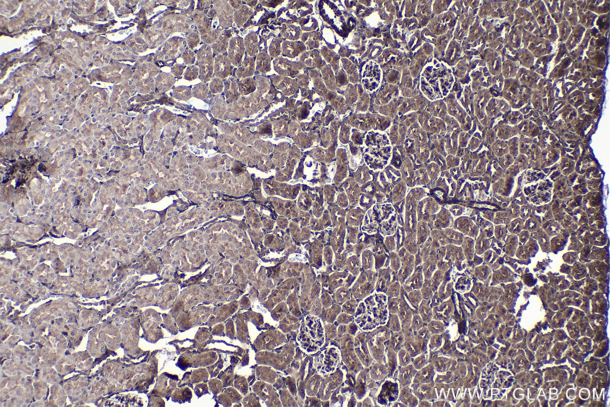 Immunohistochemical analysis of paraffin-embedded rat kidney tissue slide using KHC1453 (TGFB1I1/HIC5 IHC Kit).