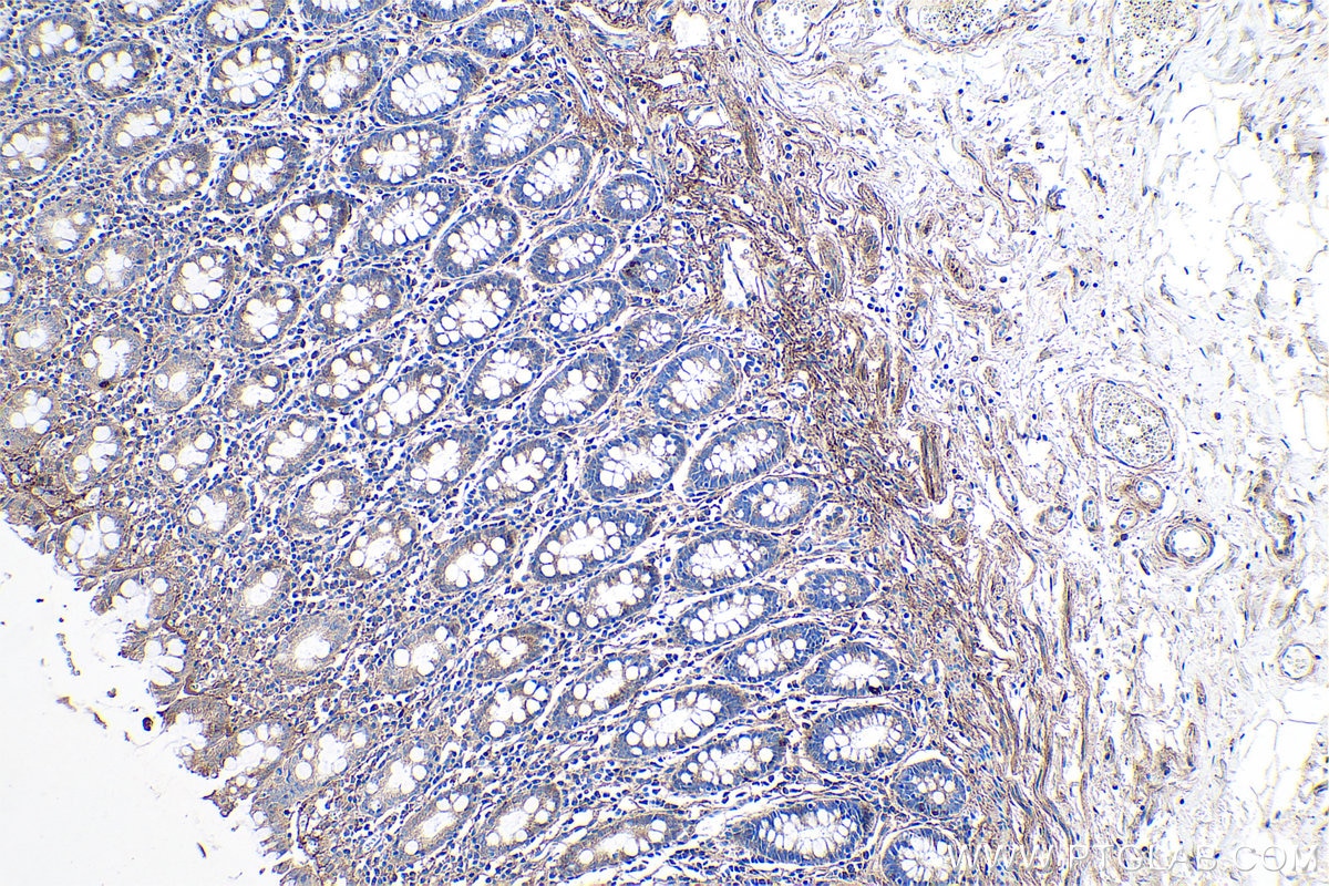 Immunohistochemical analysis of paraffin-embedded human colon tissue slide using KHC0729 (TGFBI IHC Kit).