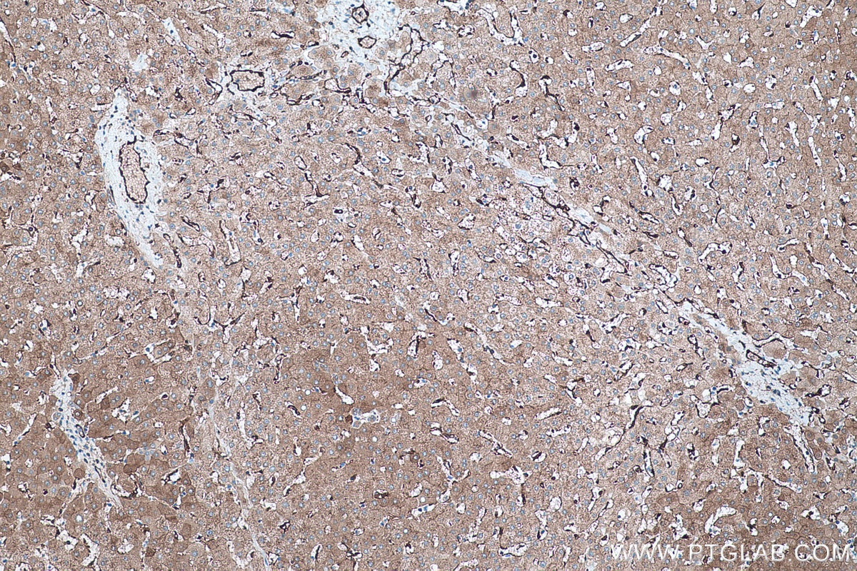 Immunohistochemical analysis of paraffin-embedded human liver tissue slide using KHC0467 (TGM2 IHC Kit).