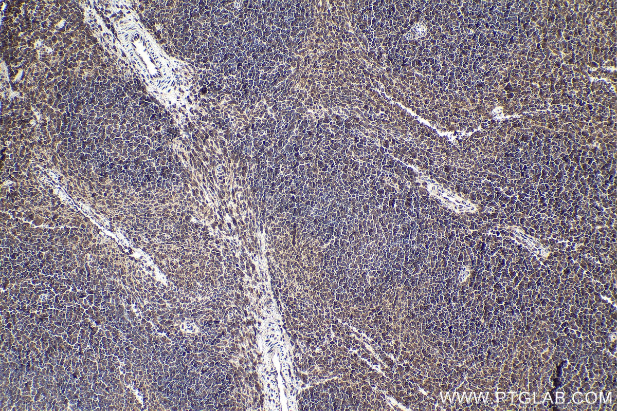 Immunohistochemical analysis of paraffin-embedded mouse spleen tissue slide using KHC1870 (THAP11 IHC Kit).