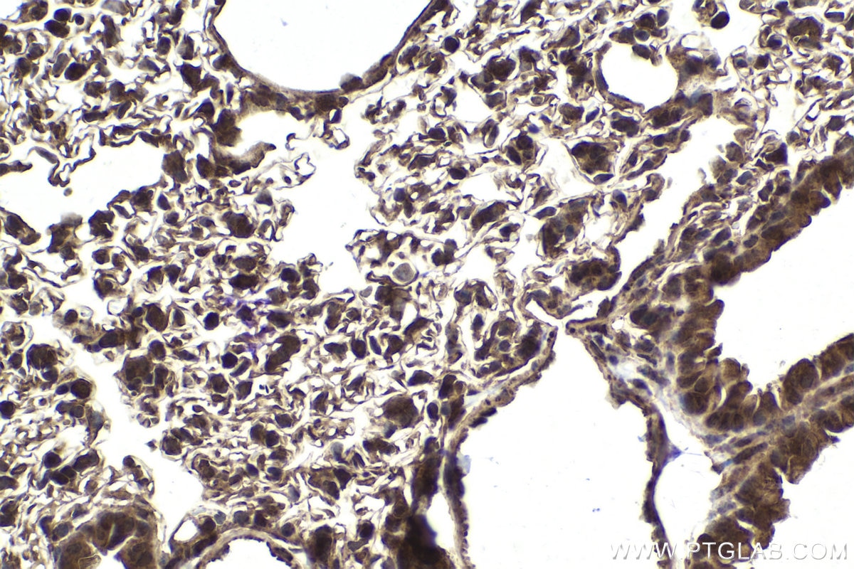 Immunohistochemical analysis of paraffin-embedded mouse lung tissue slide using KHC1870 (THAP11 IHC Kit).