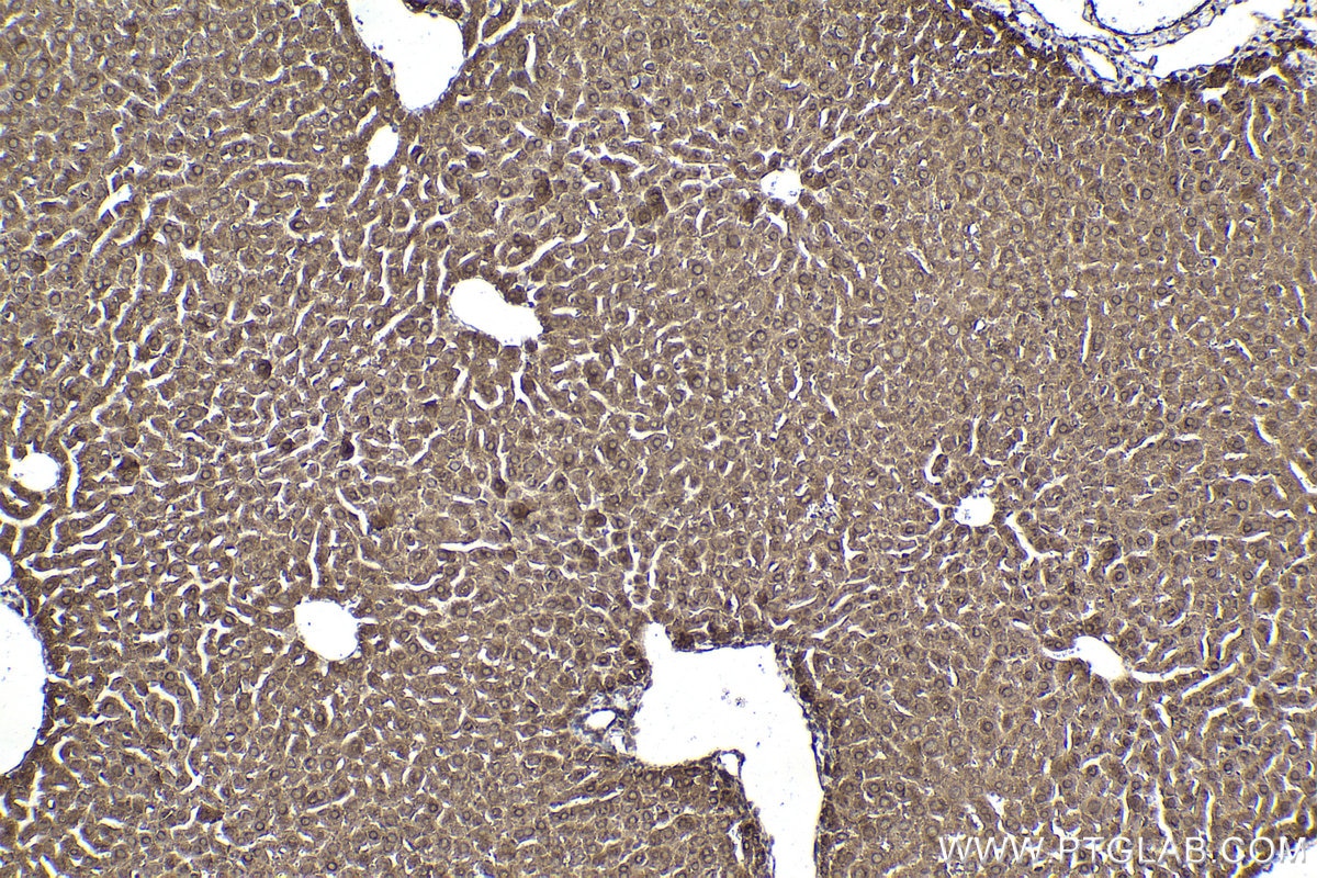 Immunohistochemical analysis of paraffin-embedded mouse liver tissue slide using KHC1870 (THAP11 IHC Kit).