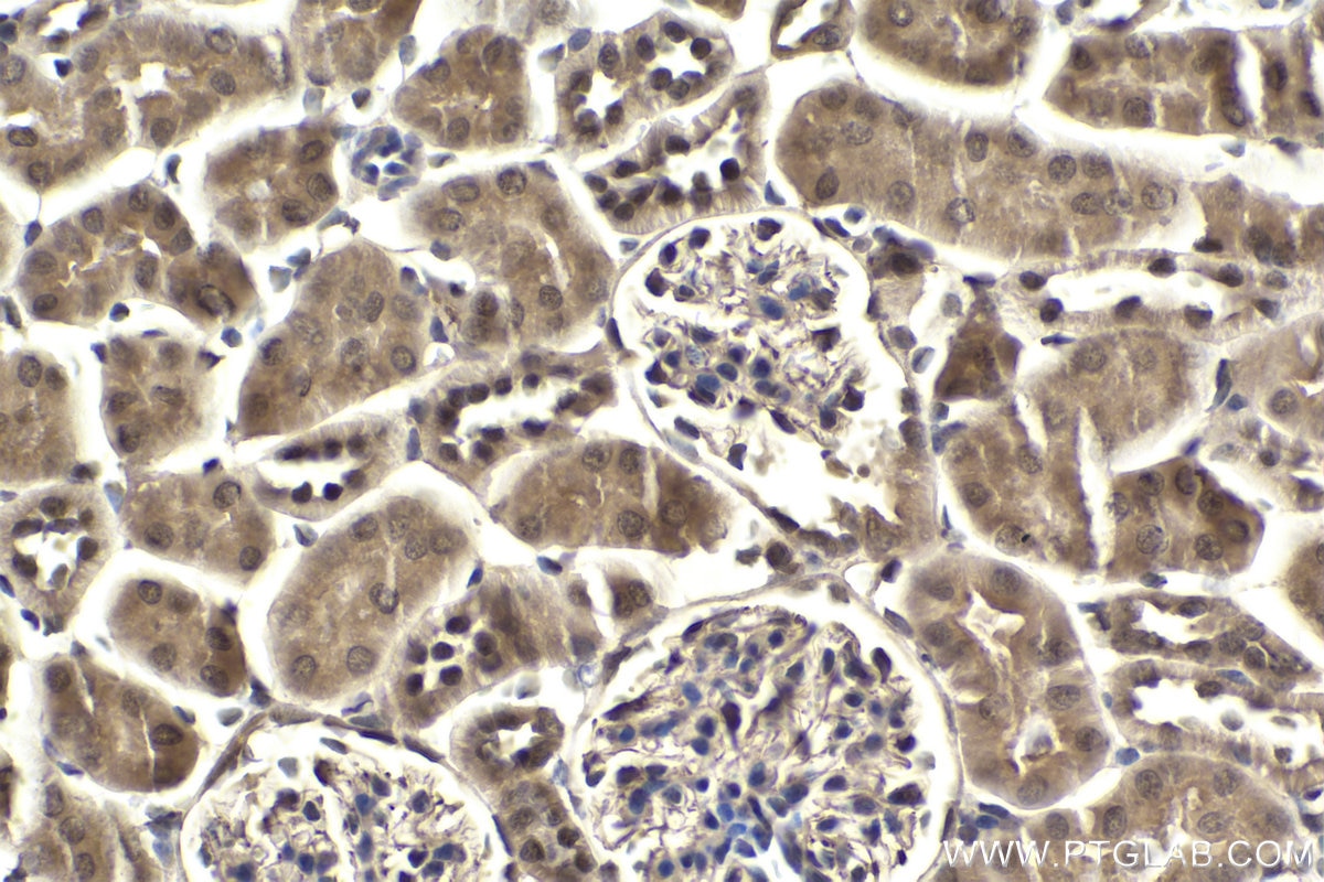 Immunohistochemical analysis of paraffin-embedded mouse kidney tissue slide using KHC1870 (THAP11 IHC Kit).