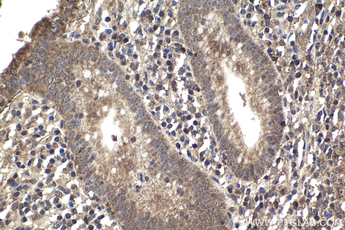 Immunohistochemical analysis of paraffin-embedded human appendicitis tissue slide using KHC1870 (THAP11 IHC Kit).