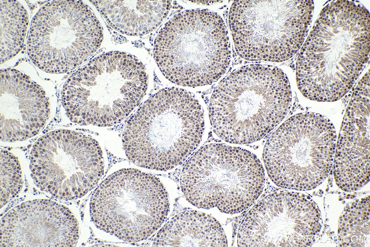 Immunohistochemical analysis of paraffin-embedded rat testis tissue slide using KHC1719 (THOC5 IHC Kit).