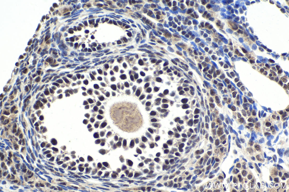 Immunohistochemical analysis of paraffin-embedded mouse ovary tissue slide using KHC1719 (THOC5 IHC Kit).