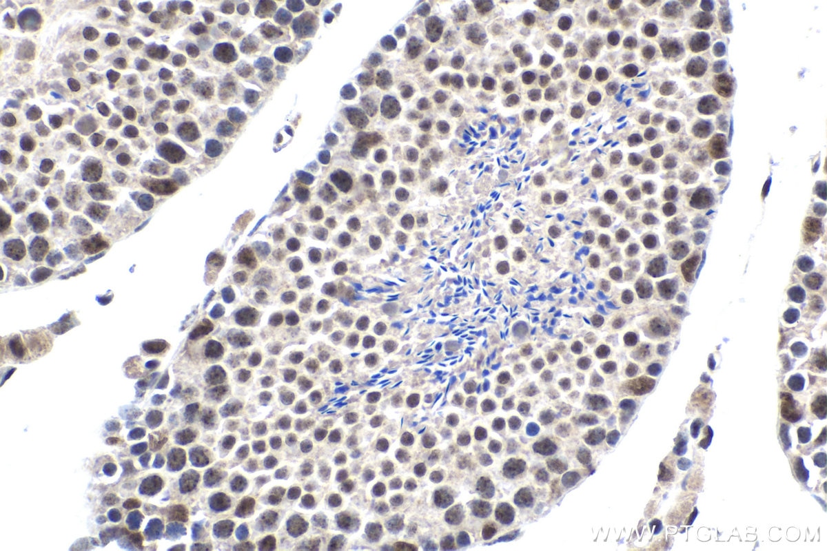 Immunohistochemical analysis of paraffin-embedded mouse testis tissue slide using KHC1719 (THOC5 IHC Kit).