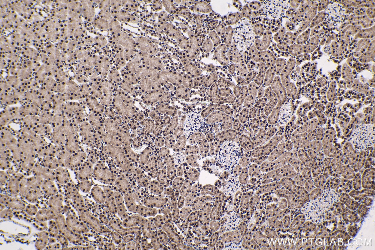 Immunohistochemical analysis of paraffin-embedded rat kidney tissue slide using KHC1786 (THOC7 IHC Kit).