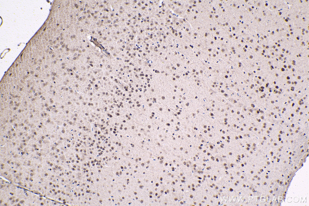 Immunohistochemical analysis of paraffin-embedded mouse brain tissue slide using KHC1523 (THRA IHC Kit).