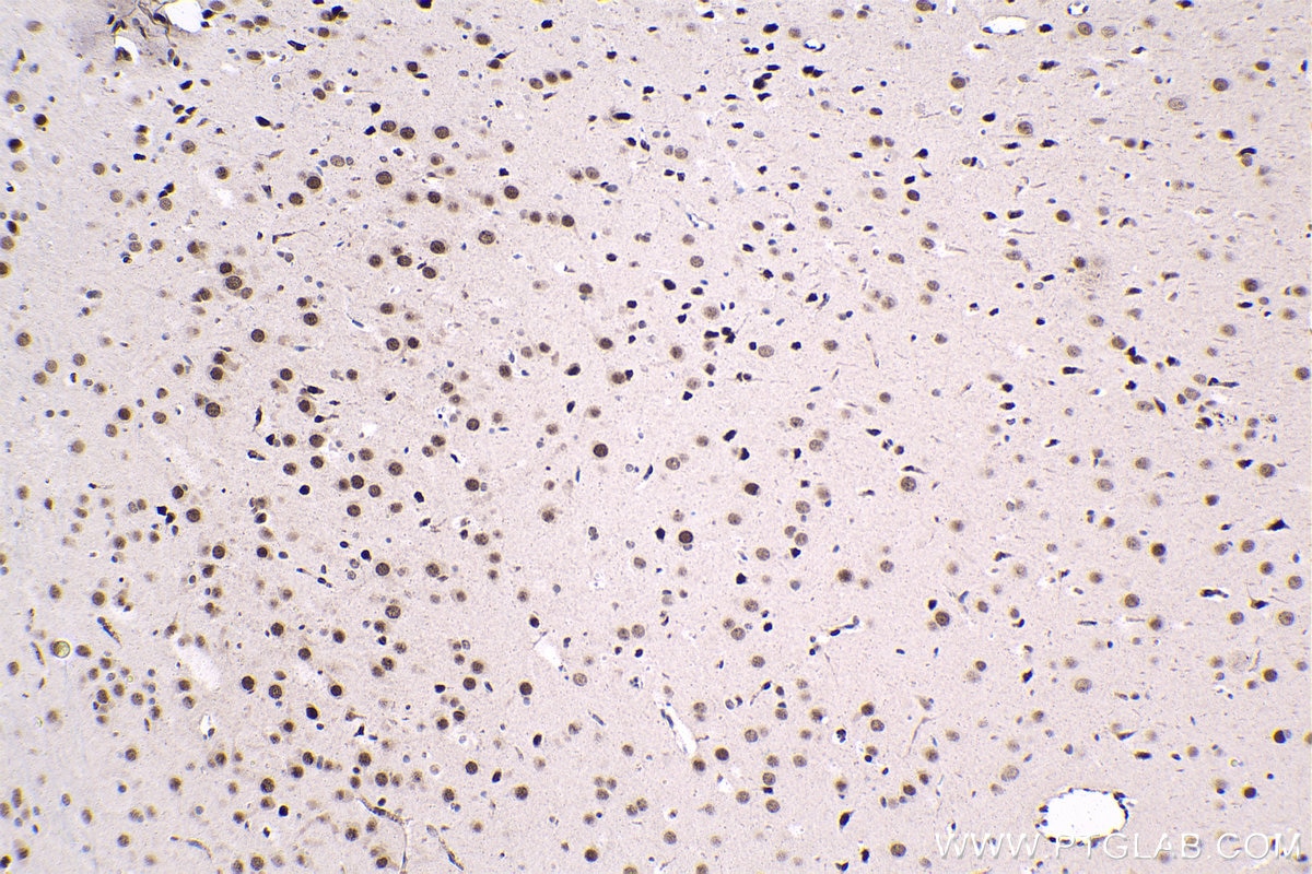 Immunohistochemical analysis of paraffin-embedded rat brain tissue slide using KHC1523 (THRA IHC Kit).