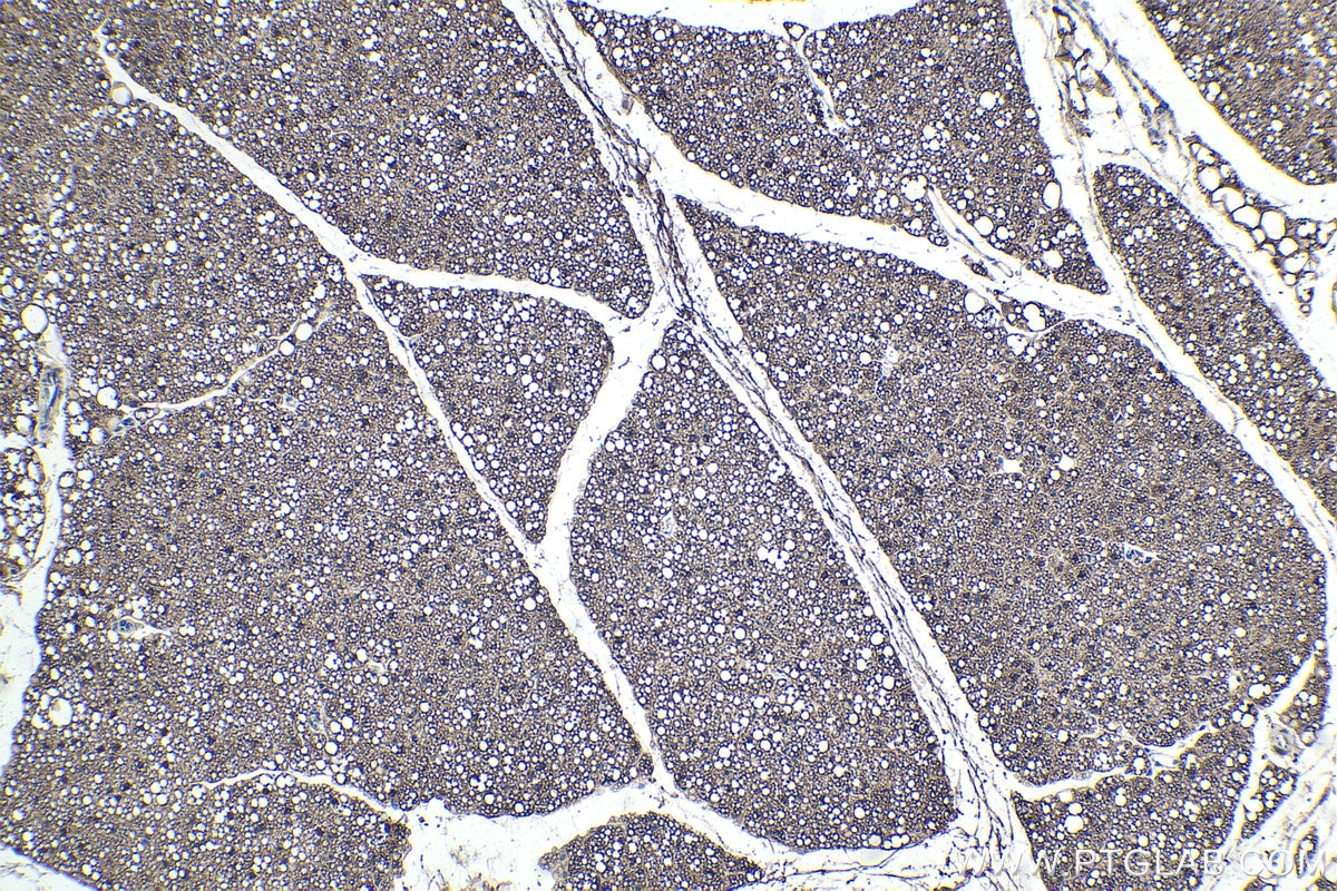 Immunohistochemical analysis of paraffin-embedded mouse brown adipose tissue slide using KHC1851 (THRSP IHC Kit).