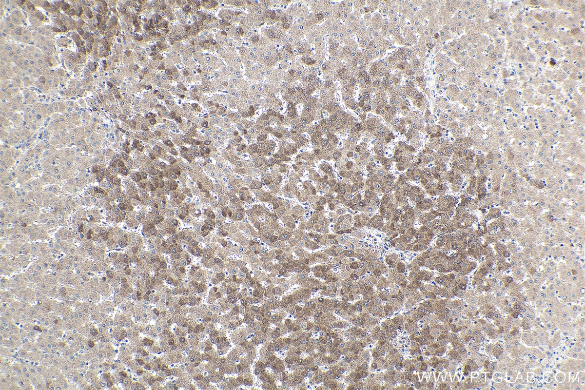 Immunohistochemical analysis of paraffin-embedded human liver tissue slide using KHC1851 (THRSP IHC Kit).