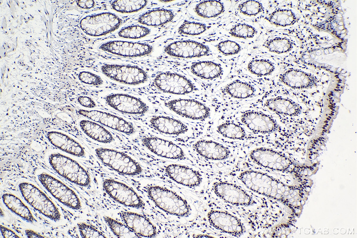 Immunohistochemical analysis of paraffin-embedded human colon tissue slide using KHC0978 (THUMPD1 IHC Kit).