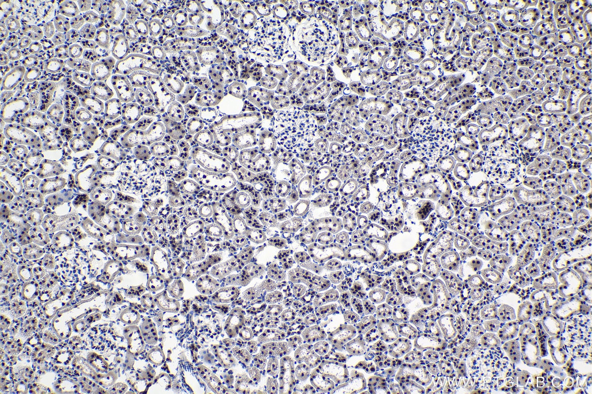 Immunohistochemical analysis of paraffin-embedded rat kidney tissue slide using KHC0978 (THUMPD1 IHC Kit).