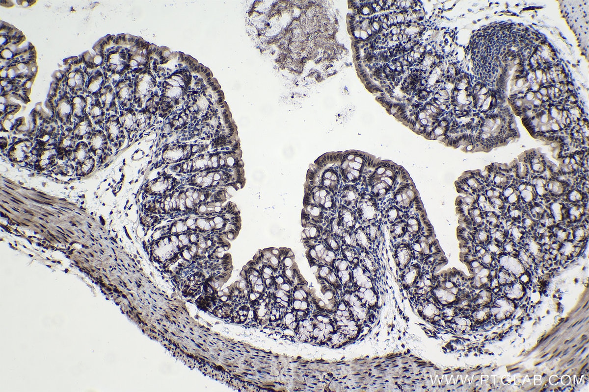 Immunohistochemical analysis of paraffin-embedded mouse colon tissue slide using KHC0978 (THUMPD1 IHC Kit).