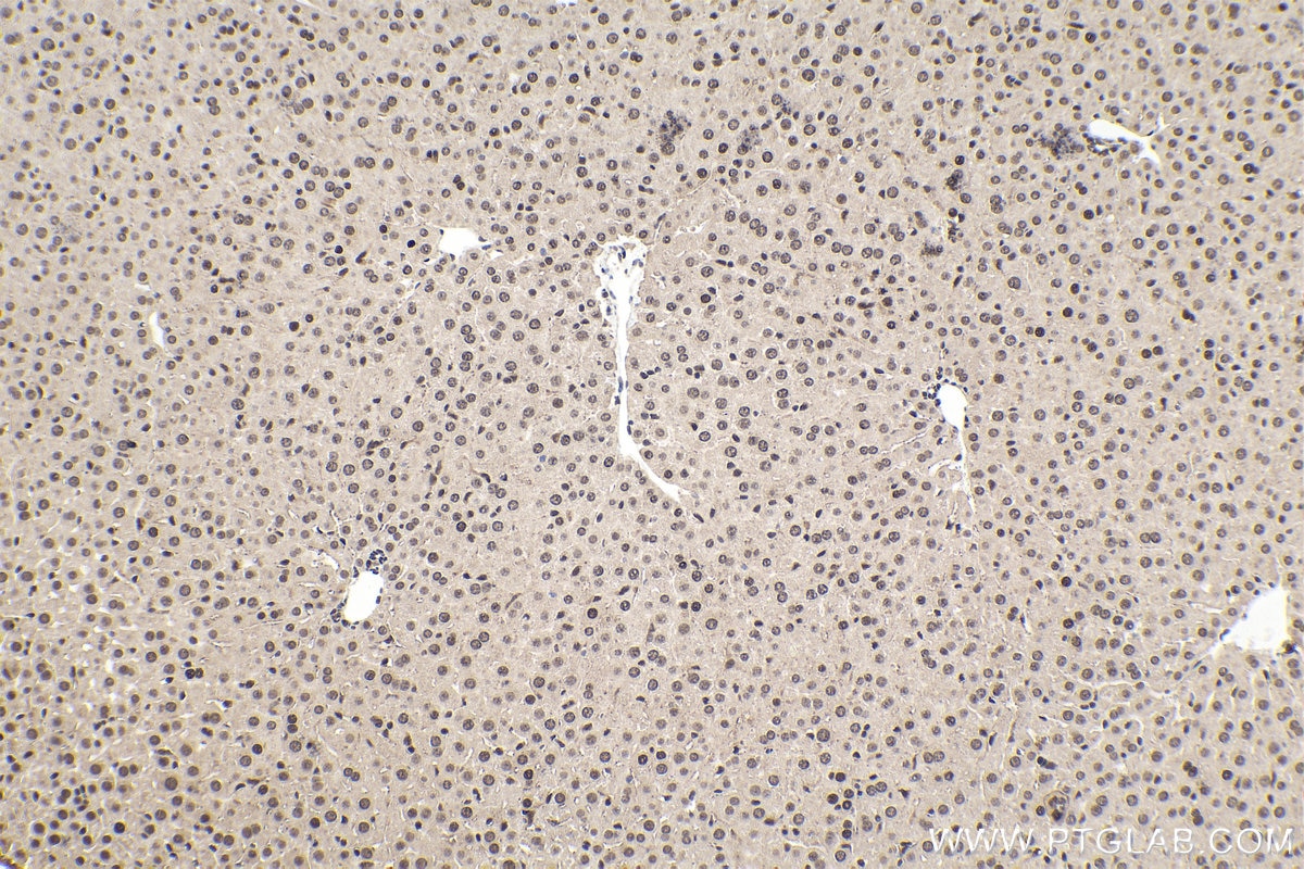 Immunohistochemical analysis of paraffin-embedded mouse liver tissue slide using KHC1578 (TIA1 IHC Kit).