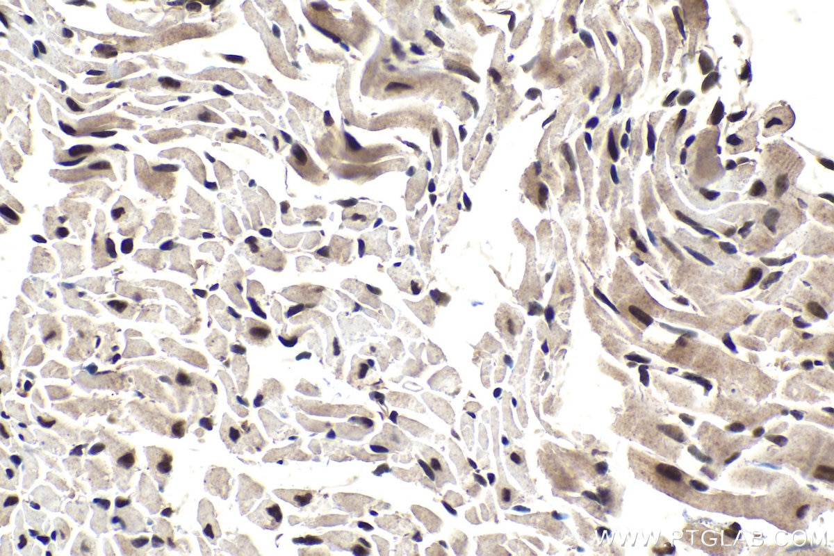 Immunohistochemical analysis of paraffin-embedded mouse heart tissue slide using KHC1578 (TIA1 IHC Kit).