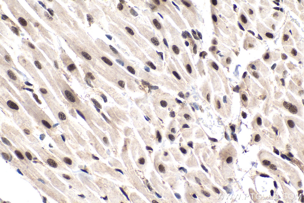 Immunohistochemical analysis of paraffin-embedded rat heart tissue slide using KHC1578 (TIA1 IHC Kit).