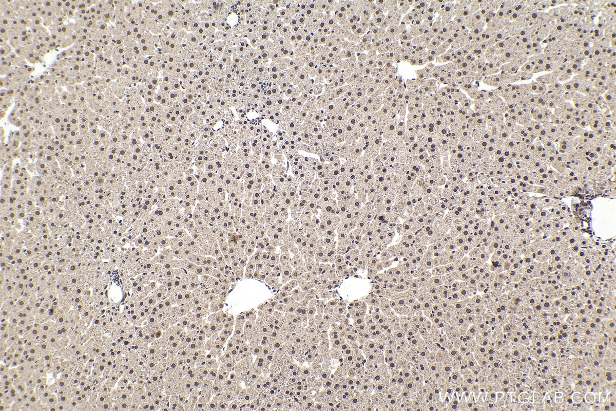 Immunohistochemical analysis of paraffin-embedded rat liver tissue slide using KHC1578 (TIA1 IHC Kit).