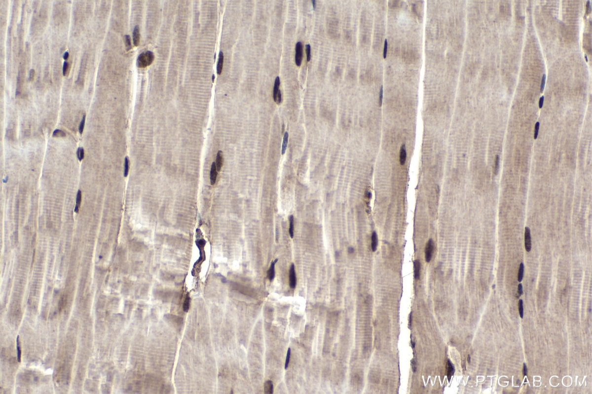 Immunohistochemical analysis of paraffin-embedded mouse skeletal muscle tissue slide using KHC1662 (TIAL1 IHC Kit).