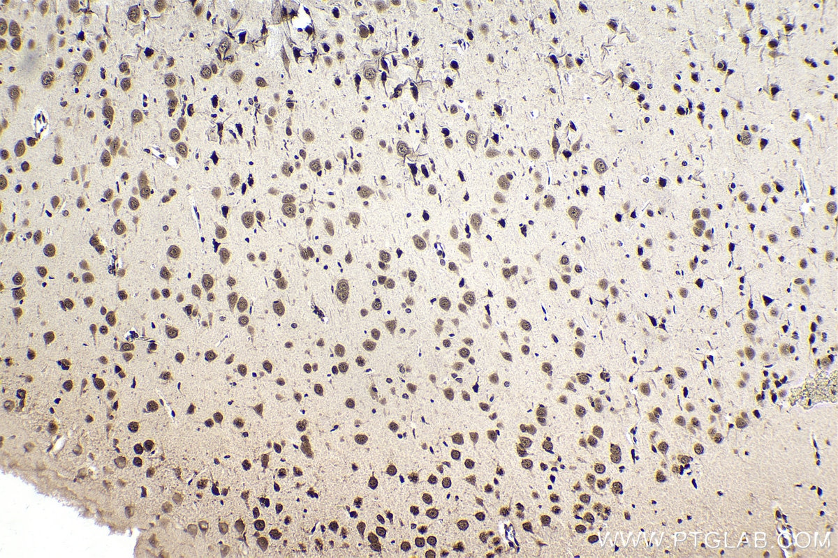 Immunohistochemical analysis of paraffin-embedded rat brain tissue slide using KHC1662 (TIAL1 IHC Kit).
