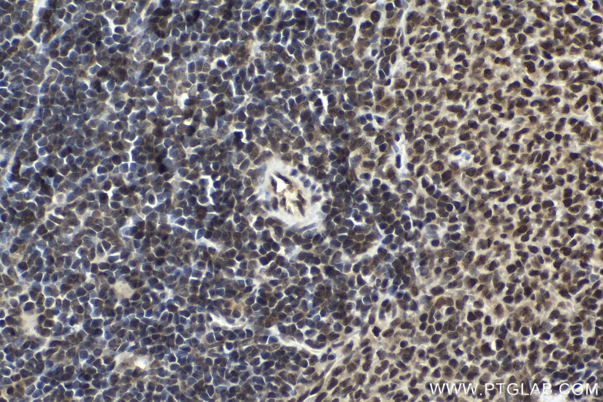 Immunohistochemical analysis of paraffin-embedded rat spleen tissue slide using KHC1662 (TIAL1 IHC Kit).