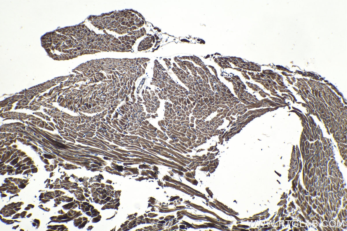Immunohistochemical analysis of paraffin-embedded mouse heart tissue slide using KHC1185 (TIMM17A IHC Kit).