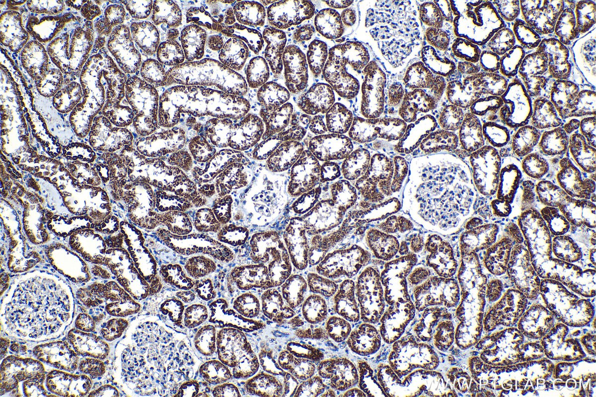 Immunohistochemical analysis of paraffin-embedded human kidney tissue slide using KHC1304 (TIMM9 IHC Kit).
