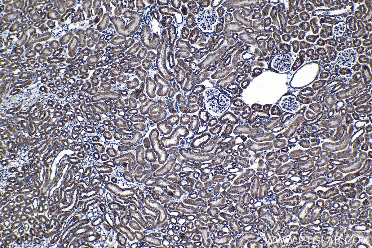 Immunohistochemical analysis of paraffin-embedded mouse kidney tissue slide using KHC1304 (TIMM9 IHC Kit).