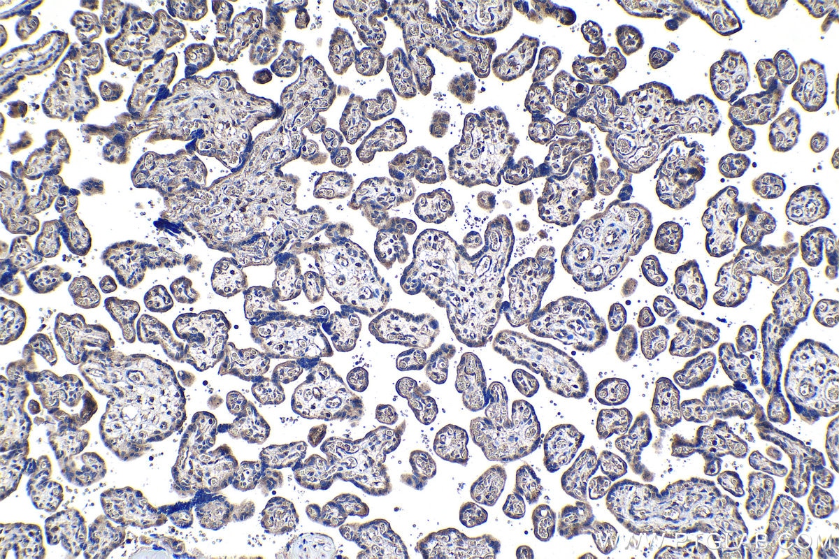 Immunohistochemical analysis of paraffin-embedded human placenta tissue slide using KHC1154 (TIMP2 IHC Kit).